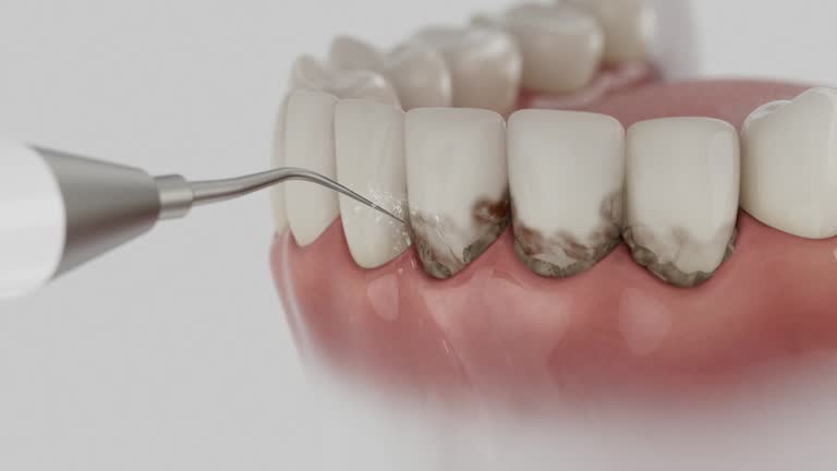 Reliable Dental contractor in Hudson, TX by Smile Center Dentistry
